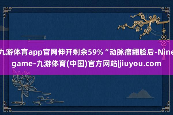 九游体育app官网伸开剩余59%“动脉瘤翻脸后-Ninegame-九游体育(中国)官方网站|jiuyou.com